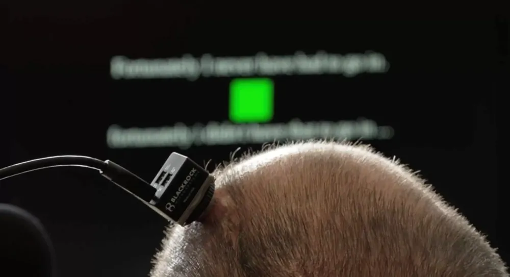 The UC Davis brain implant translates thoughts to spoken words with emotion