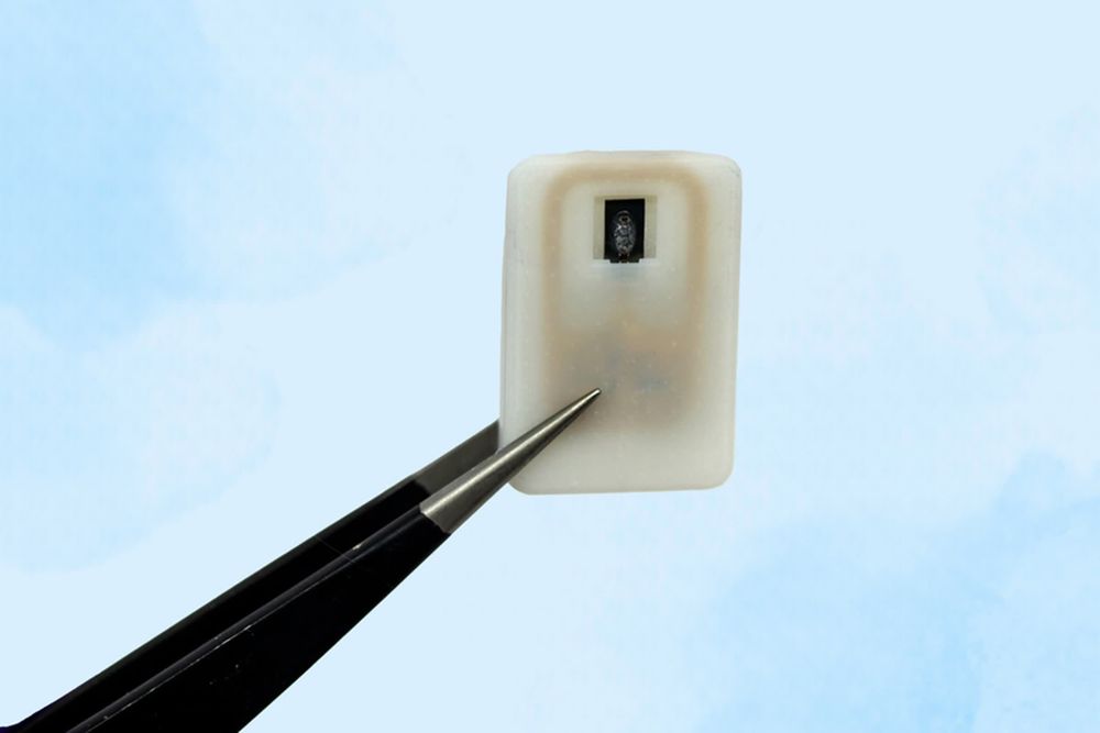 MIT unveils an implant that automatically treats low blood sugar in those with type 1 diabetes